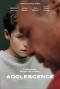 DVD-R: ADOLESCENCE - Series 1 Ep.1+2 (2025)
